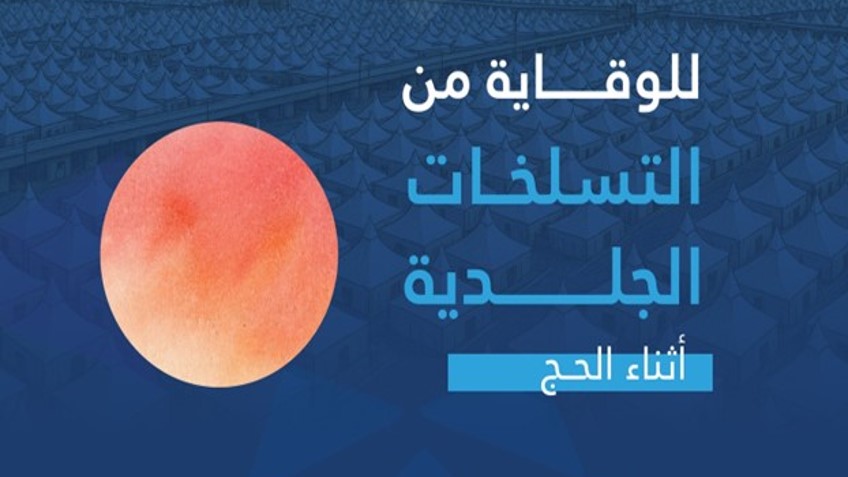 للوقاية من التسلّخات الجلدية أثناء الحج